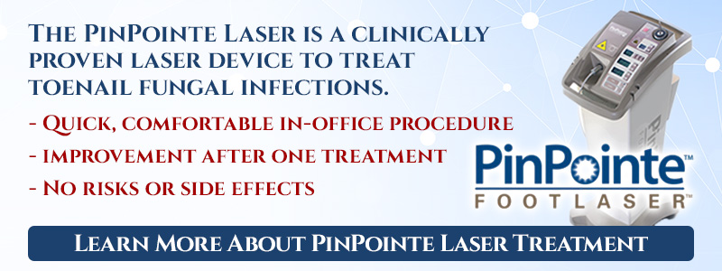 PinPoint Laser